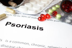 Psoriasis Rx shutterstock_274834217 PAID LIC Psoriasis Rx shutterstock_274834217 PAID LIC
