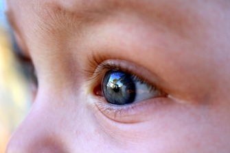 Kids eye-2408020_1920 by virginia332 at Pixabay FREE LIC CC00 Kids eye-2408020_1920 by virginia332 at Pixabay FREE LIC CC00