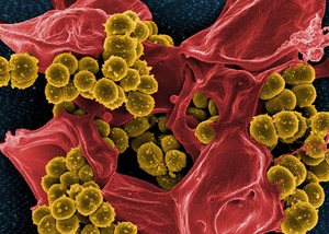 bacteria-808158_1920 by skeeze PIXABAY Free Lic CC0