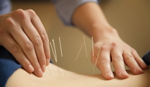 acupuncturist 2